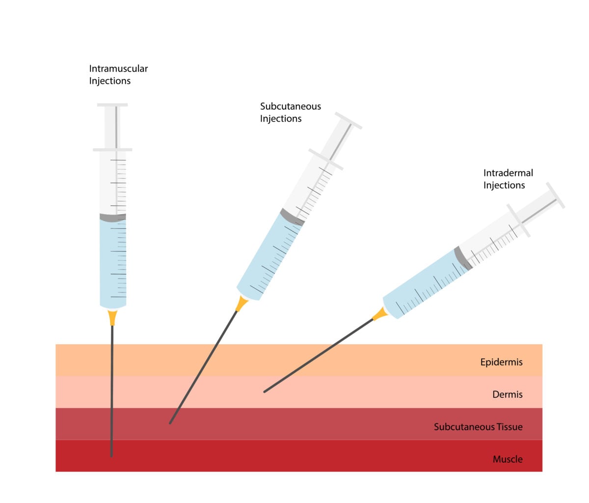 Safe injection techniques - Alpha Male Clinic